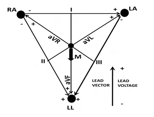 Figure for Question 106