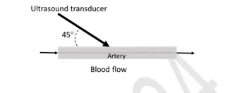 Figure for Question 162